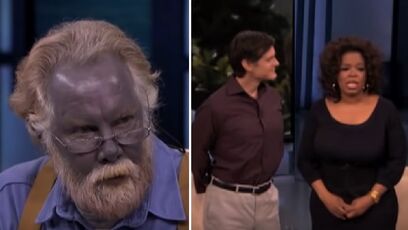 Remember the guy who turned Blue?