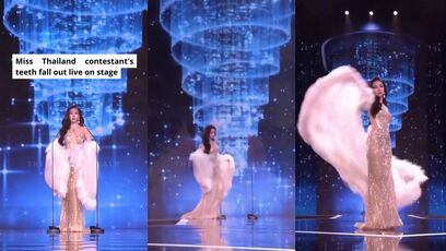 Miss Thailand contestant's teeth fall out during the pageant