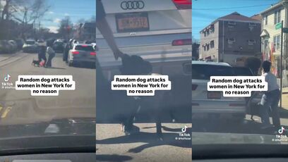 Another random pit bull attack