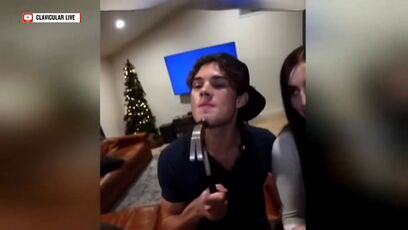 Stupid people are hitting themselves with hammers for "looksmaxxing"