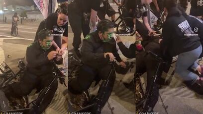 Protester shot in the EYE