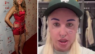 Amanda Bynes addresses new look, confirms surgery