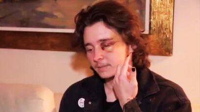 ICE protester says he's "blind for life, have fractures in my skull they can't fix"