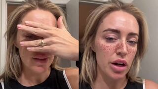 Woman gets freckles tattooed on her face and it looks ridiculous