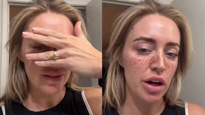 Woman gets freckles tattooed on her face and it looks ridiculous